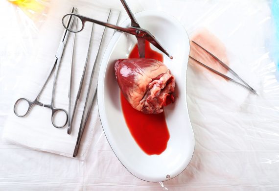 Organ Donation: Insights from a Heart Failure Cardiologist