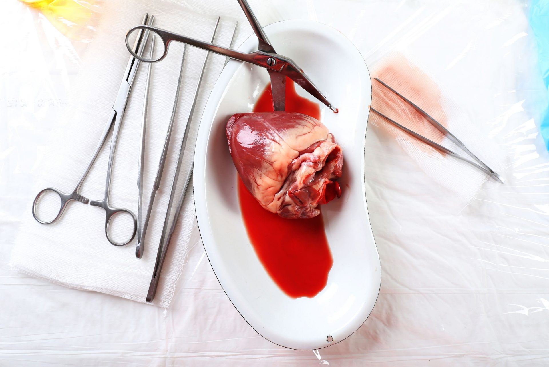 Organ Donation: Insights from a Heart Failure Cardiologist