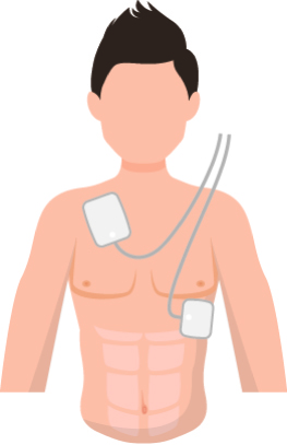 AED pads on a casualty