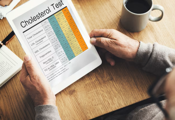 Hands holding up blood cholesterol test report.