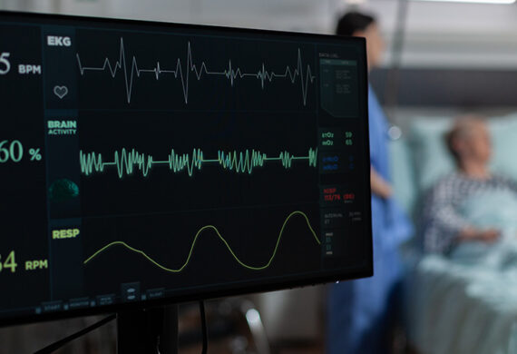 A medical monitor displaying real-time EKG heart rate waves
