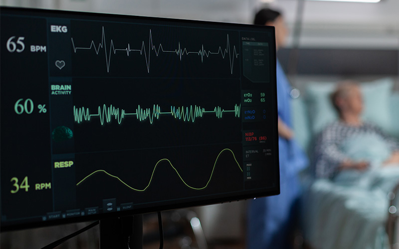 A medical monitor displaying real-time EKG heart rate waves