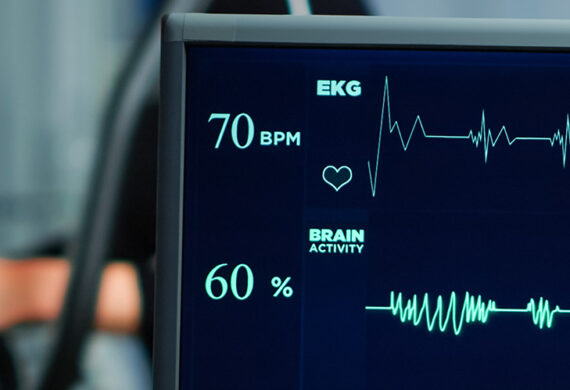 Medical monitor displaying heart rate and brain activity lines.