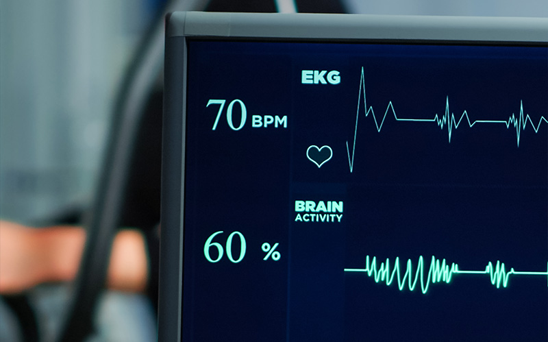 Medical monitor displaying heart rate and brain activity lines.